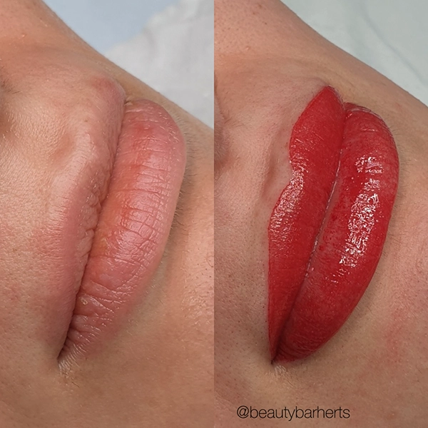 semi permanent lips broxbourne