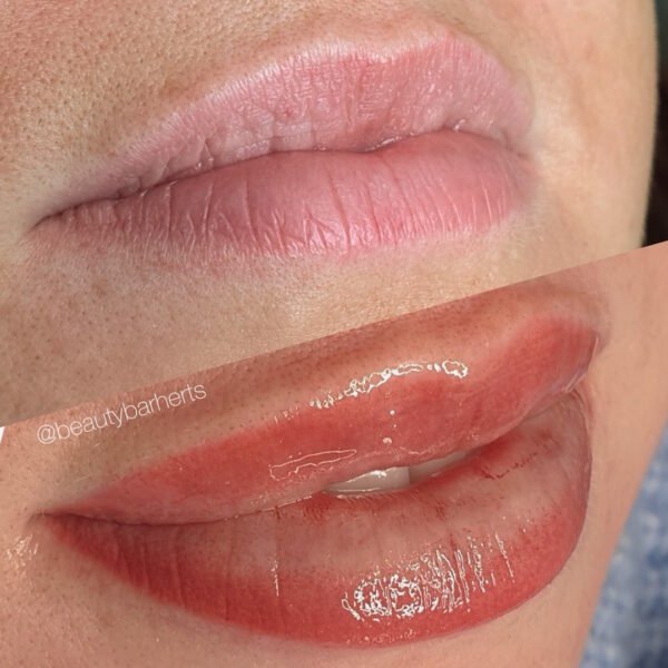 Revive Your Lips – Banishing Dark Tones with Lip Neutralization