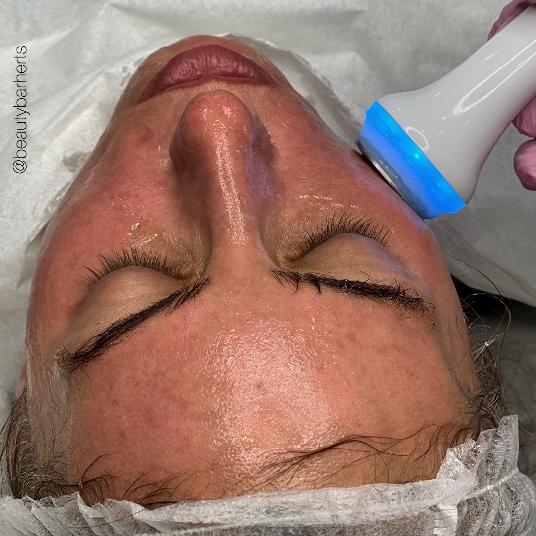 ultrasound facial hertfordshire broxbourne