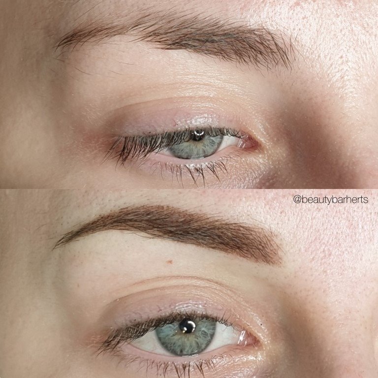 thin eyebrow treatment