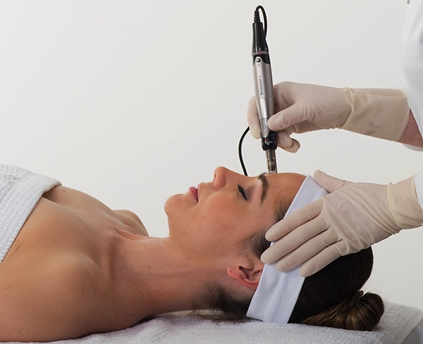 dermapen skin treatment hertfordshire