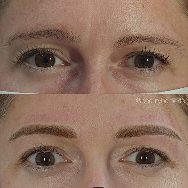 permanent eyebrow treatment